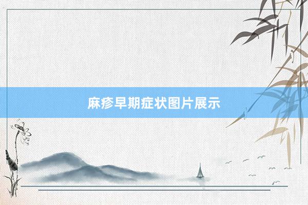 麻疹早期症状图片展示